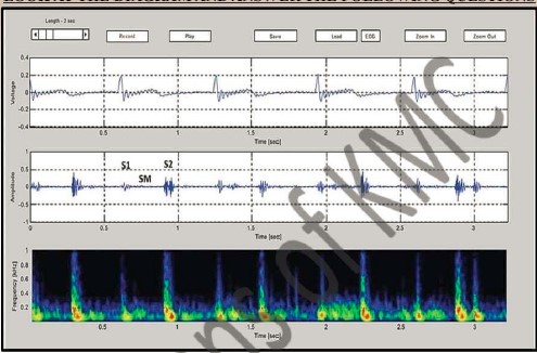 KMC PHYSIOLOGY OSPE 2