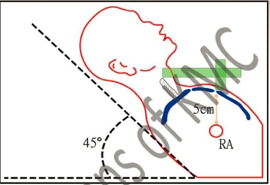 KMC PHYSIOLOGY OSPE 