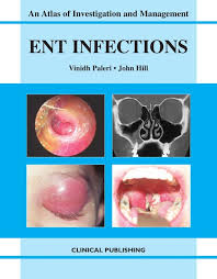 ENT INFECTIONS PDF BOOK